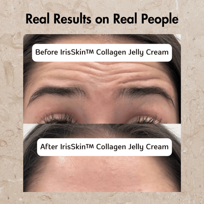 IrisSkin™️ Collagen Jelly Cream